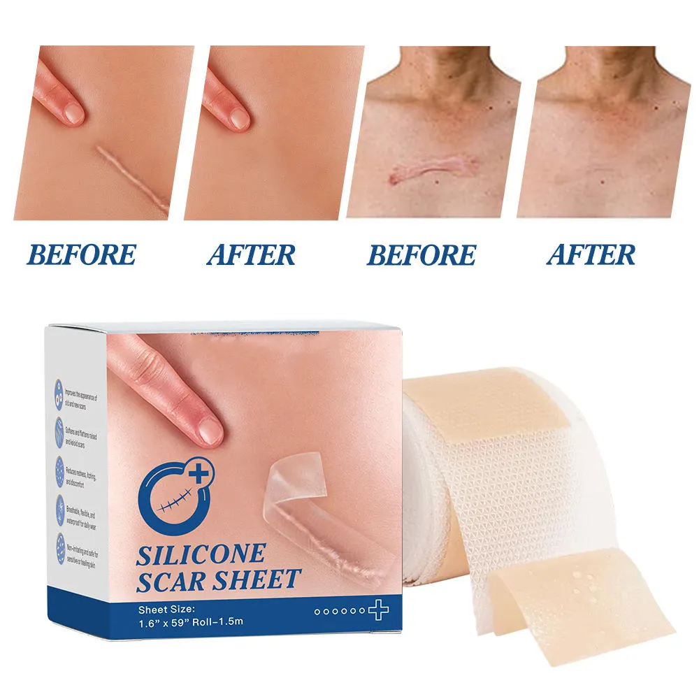 CE/FDA Certified medical silicone tape for Scar Gentle Removal - Medical Adhesive 5