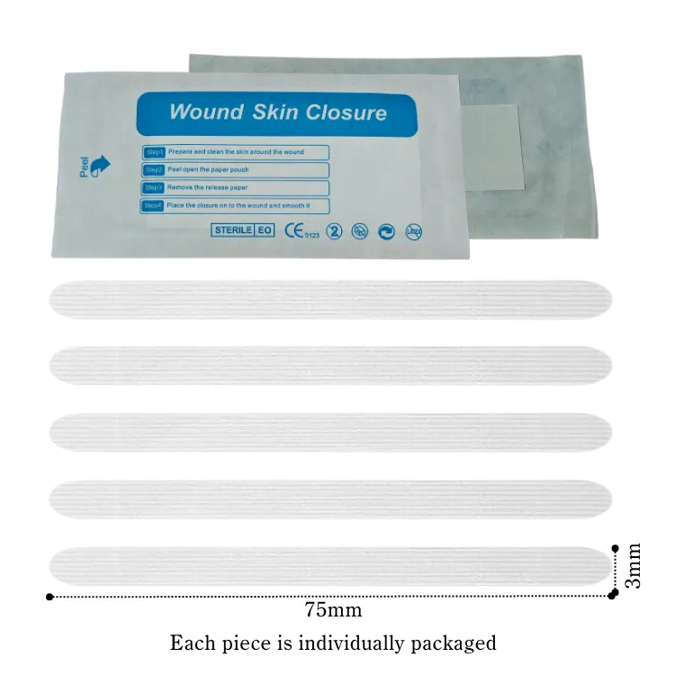 Hypoallergenic Medical-Grade Sterilized Skin Closure Strips for Gentle Laceration Repair & Post-Surgical Wound Care 4