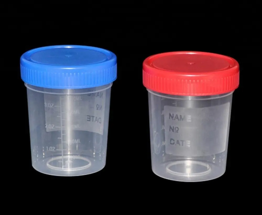 Disposable sterile plastic medical cup urine cup hospital urine container with screw cap 6