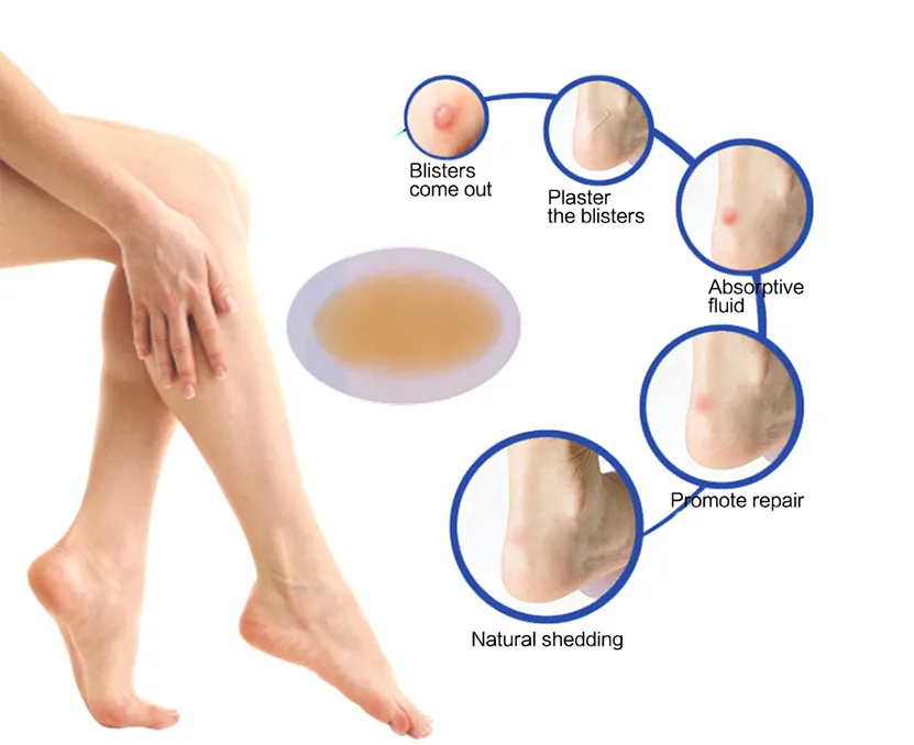 Medical Adhesive Hydrocolloid Foot Patch Dressing Medium Relieves Blister Patchs 6