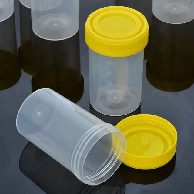 Disposable sterile plastic medical cup urine cup hospital urine container with screw cap