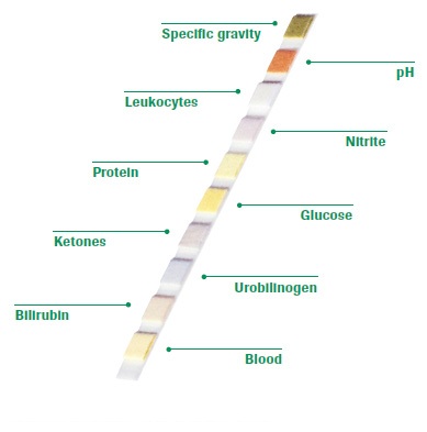 100 urine creatinine test strips, professional quality test for 10 parameters with FDA,CE,ISO