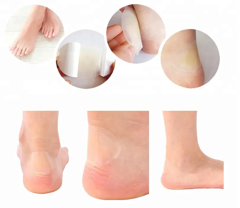 Medical Adhesive Hydrocolloid Foot Patch Dressing Medium Relieves Blister Patchs 4