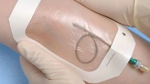 Medical Waterproof Transparent Adhesive IV Wound Dressing 6
