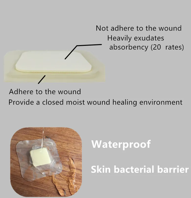 Hydrocolloid Foam Pad Wound Dressing 5