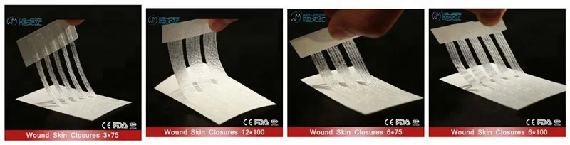 Wound skin closures strips 3
