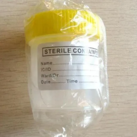 Disposable sterile plastic medical cup urine cup hospital urine container with screw cap 4