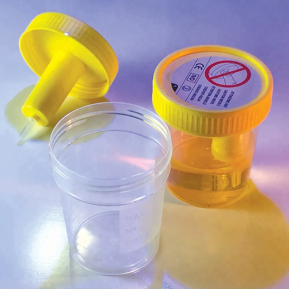 Disposable sterile plastic medical cup urine cup hospital urine collection container with screw cap 3