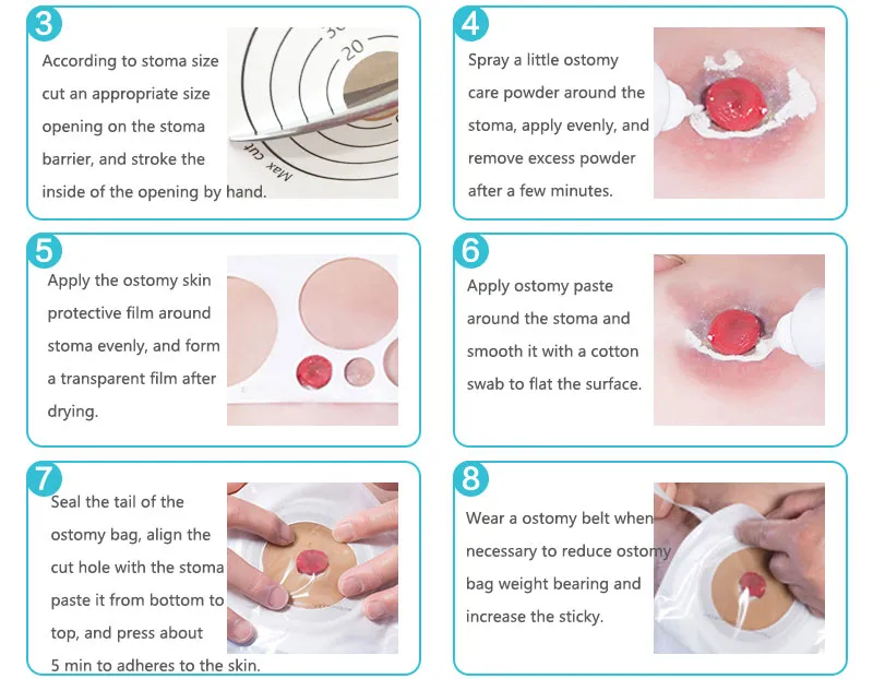 useful colostomy bags
