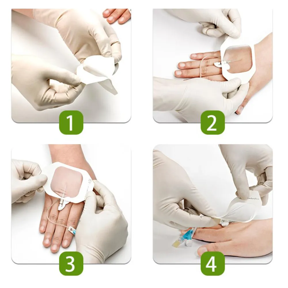 Sterile transparent film wound dressing 9