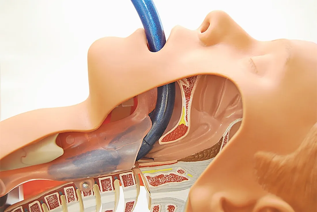 silicone laryngeal mask