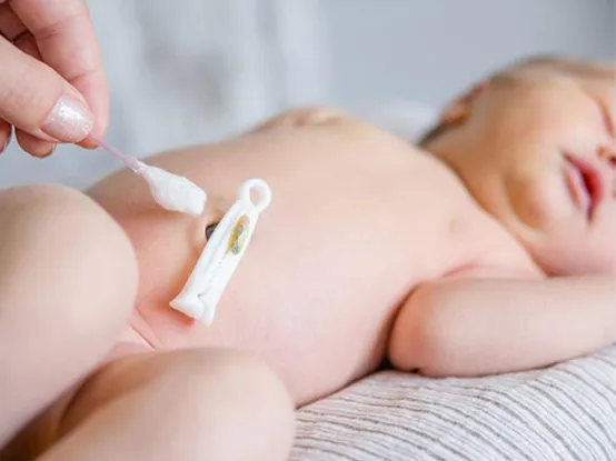 Sterilized umbilical cord clamp 12