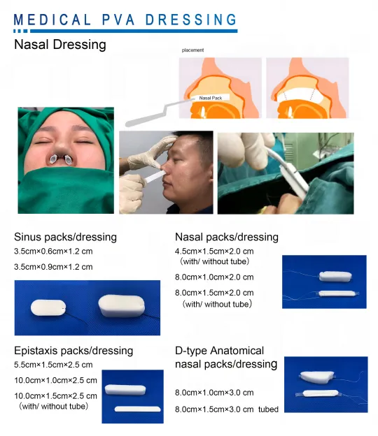 Medical Disposable PVA Dressing Nasal Sponge Dressing Hemostatic Sponge 10